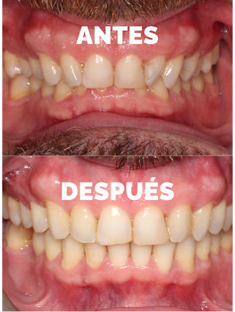 caso_antes_despues_1