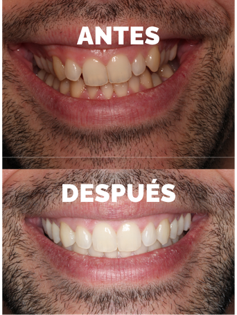 caso_antes_despues_2