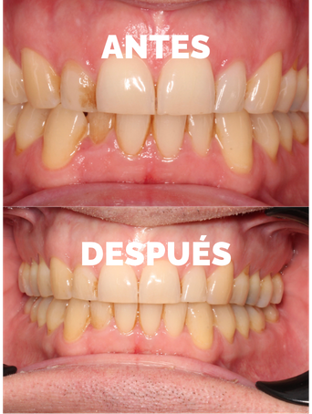 caso_antes_despues_3